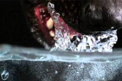 Signs, treatment and prevention of HEAT-STROKE in dogs